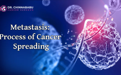 Metastasis: Process of Cancer Spreading