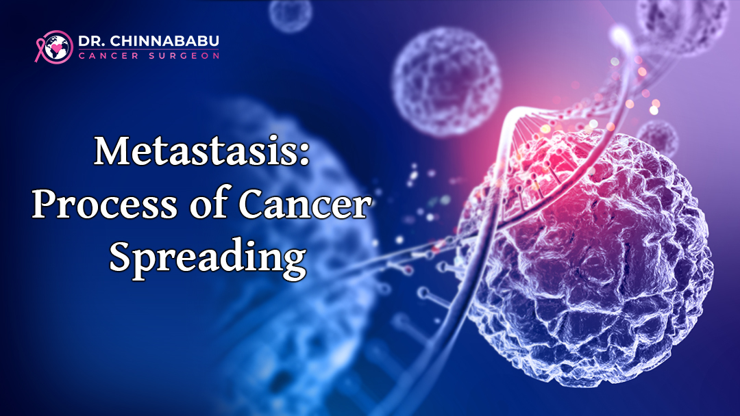 Metastasis: Process of Cancer Spreading
